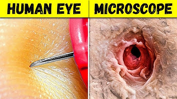 50 Things You Can See Only Under Microscope