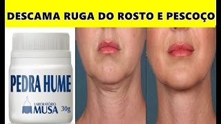 Creme para Pele – Isso é mais Forte do que Ácido