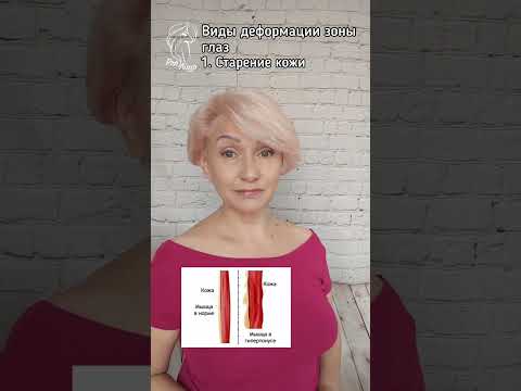 ДЕФОРМАЦИИ В ЗОНЕ ГЛАЗ. 1. СТАРЕНИЕ КОЖИ
