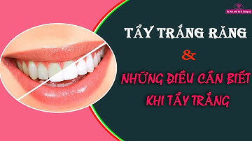 Tẩy trắng răng | Tt niềng răng quốc tế Diamond