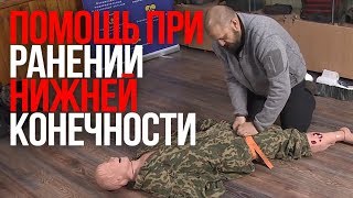 Ранение нижней конечности | Открытый перелом | Огнестрельное ранение