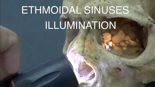 Sinus Ethmoïdaux - Éclairage
