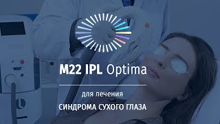 Как вылечить синдром сухого глаза за 4 процедуры? C помощью Optima IPL (M22)!