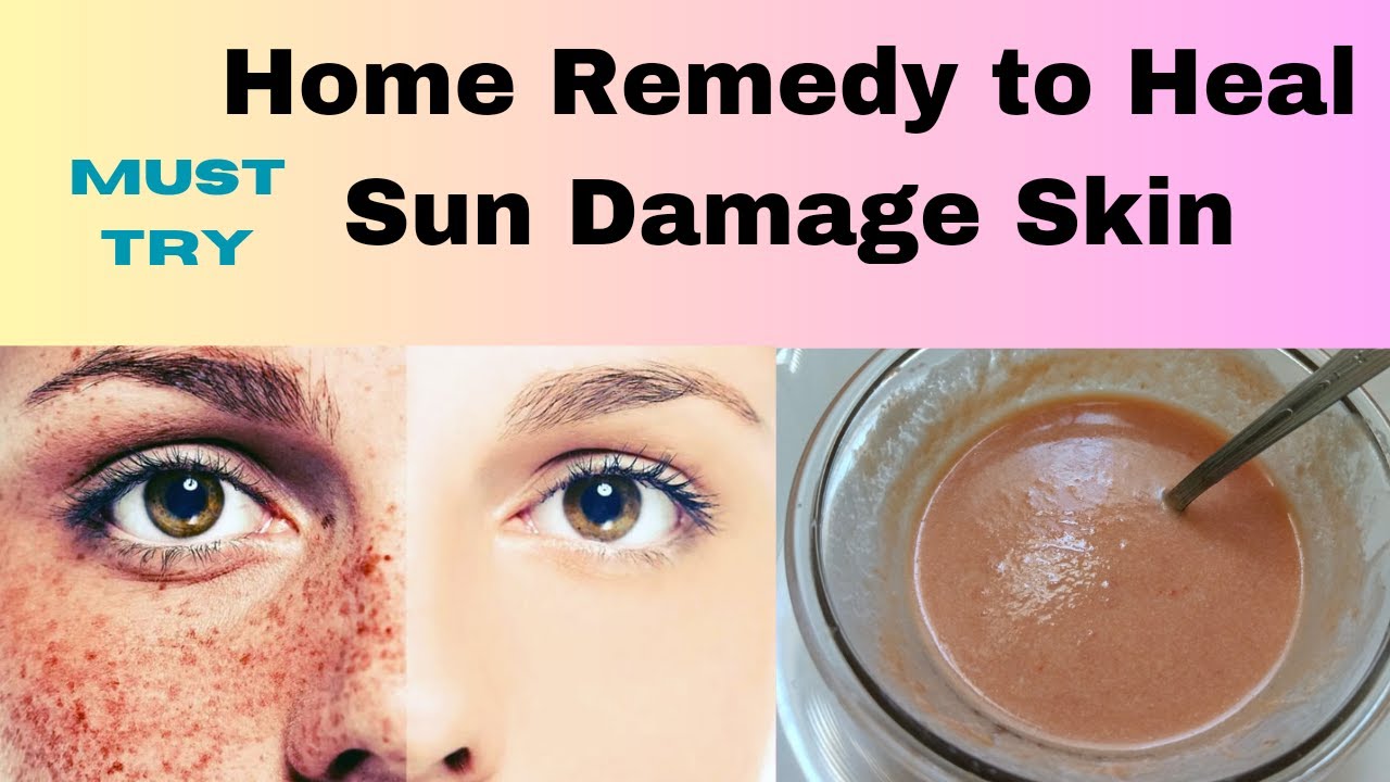 DIY Sun Damage Skin Treatment at Home, Summer Skin Care टैनिंग, झाइयों
