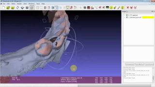 Advanced Alignment Tips