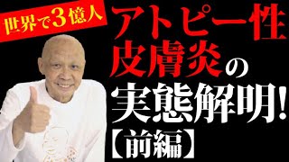 アトピー性皮膚炎【前編】古今東西 世界の状況を解説 2億人が悩む病の原因は？【初台・蔡内科皮膚科クリニック】