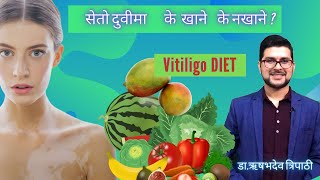 सेतो दुवी मा के खाने के नखाने?Foods to avoid in vitiligo [ Vitiligo Diet Restrictions]