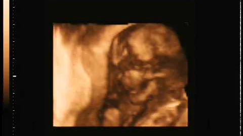 Brandon Kelly Watson - 16 Weeks