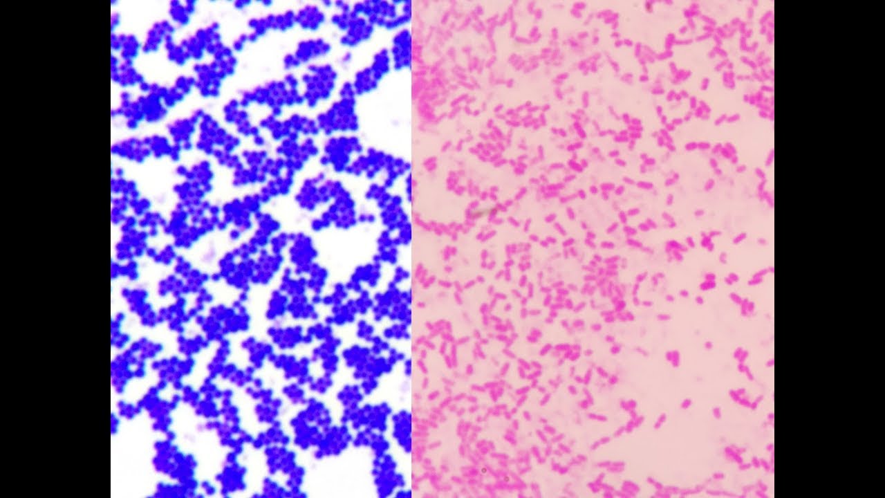 staphylococcus epidermidis gram stain