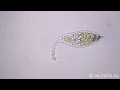 Lacrymaria(a ciliate) loses its head / У инфузории оторвалась убежала голова