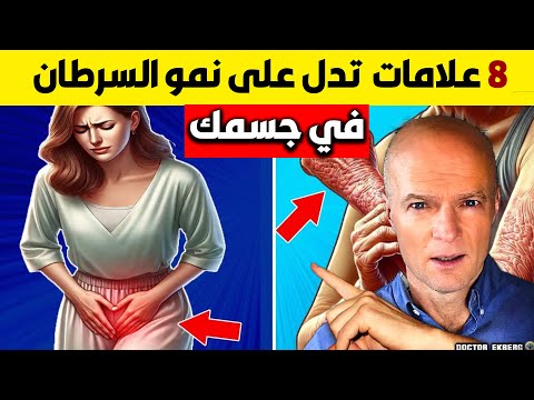 الحقيقة الكاملة اعراض وجود سرطان في الجسم د اكبيرج