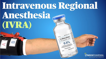 IVRA (Intravenous Regional Anesthesia): Theory, tips and tricks