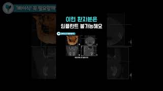 이런 환자분은 임플란트 불가능해요