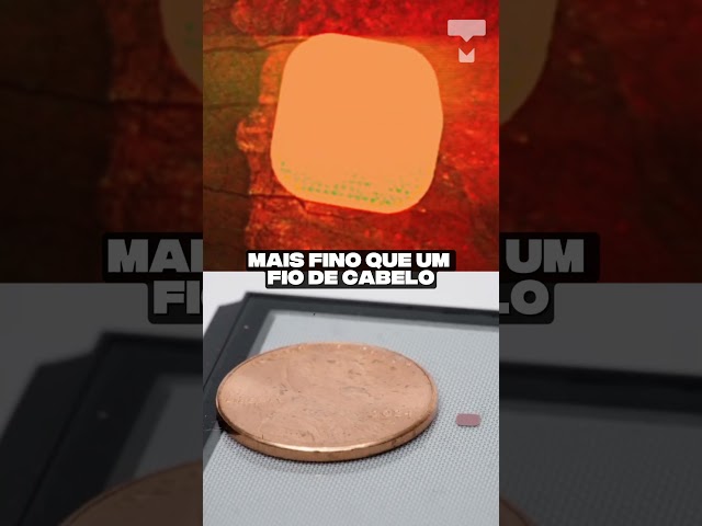 Imagem de MULHER CEGA VOLTA A LER COM CHIP NA RETINA!
