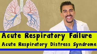 acute respiratory failure vs ards part 5 for nursing students