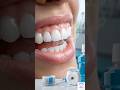 Mouthwash Can’t Fix THIS #Mouthwash #TeethCleaning#Dental #OralHygiene #GumCare #FreshBreath #Teeth