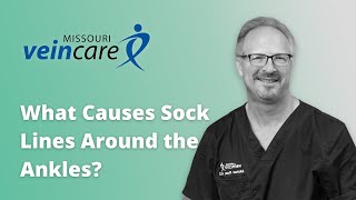 Unveiling the Mystery Behind Sock Lines
