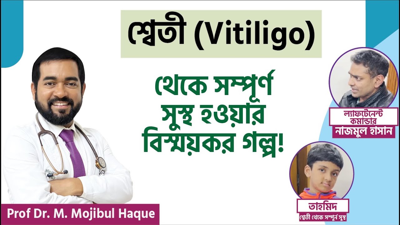 অল্প সময়ে তাহমিদ যে ভাবে শ্বেতী রোগ থেকে মুক্তি পেলেন। ACRH | Dr Haque