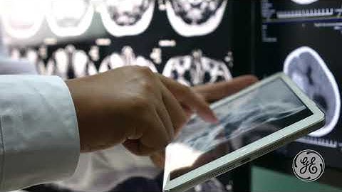 GE Healthcare | Integrating AI into the Radiologist Workflow (20s)