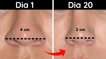 ¿Se puede reducir el tamaño de la nariz sin cambiar la forma?