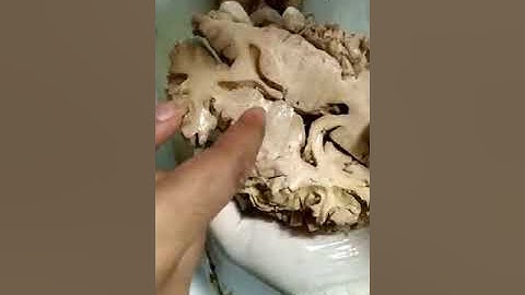 Brain and related structures.(4)