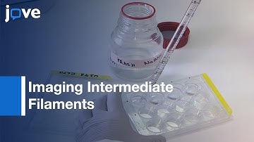 Visualizing Microtubules: 2D Direct Stochastic Optical Reconstruction Microscopy l Protocol Preview