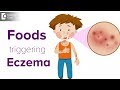 Foods triggering eczema flare up | Help your child avoid the itch! - Dr. Udhay Sidhu