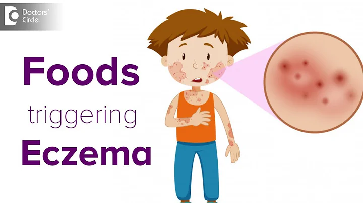 Foods triggering eczema flare up | Help your child avoid the itch! - Dr. Udhay Sidhu - DayDayNews