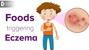 What fruits can trigger eczema?