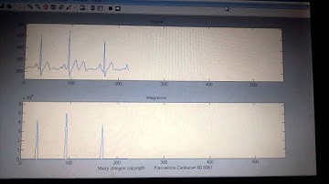 Pan-Tompkins Algorithm in Matlab