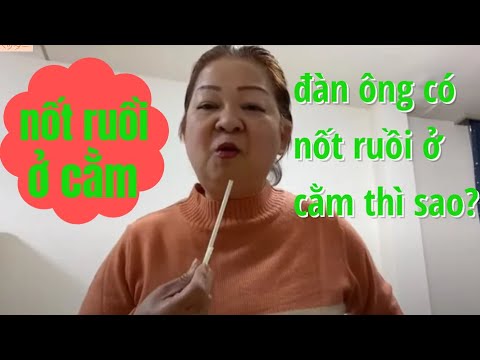 Video TỬ VI TƯỚNG SỐ Nốt Ruồi Đen Ở Cằm Có Giàu Không Đàn... - youtube