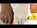 Lemon Peel Skin Treatment get Glowing Skin Instantly and Permanent - Apple Paguio7