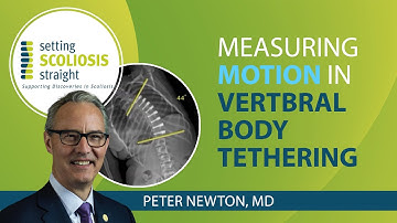 Evaluating Spinal Motion: Vertebral Body Tethering vs. Spinal Fusion