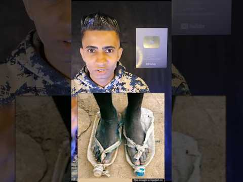 فتاة لديها شبشب مقطع أصبحت تمتلك جزمة كريستيانو رونالدو النادرة اكسبلور