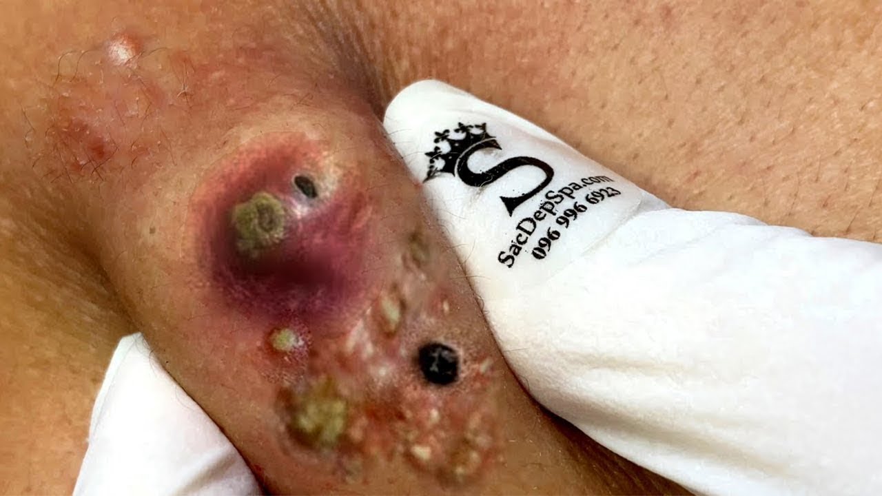 𝑺𝒐𝒐𝒕𝒉𝒊𝒏𝒈 𝑭𝒂𝒄𝒊𝒂𝒍 𝑻𝒓𝒆𝒂𝒕𝒎𝒆𝒏𝒕 𝒇𝒐𝒓 𝑺𝒕𝒓𝒆𝒔𝒔 𝑹𝒆𝒍𝒊𝒆𝒇 | 𝑫𝒆𝒆𝒑 𝑪𝒍𝒆𝒂𝒏𝒊𝒏𝒈 & 𝑪𝒂𝒍𝒎𝒊𝒏𝒈 𝑴𝒂𝒔𝒔𝒂𝒈𝒆 𝒂𝒕 𝑳𝒖𝒙𝒖𝒓𝒚 𝑺𝒑𝒂 #887491