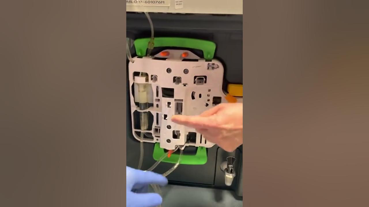 Tablo Manual blood return YouTube