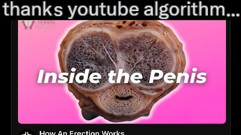 "I read this post in Matt Rose