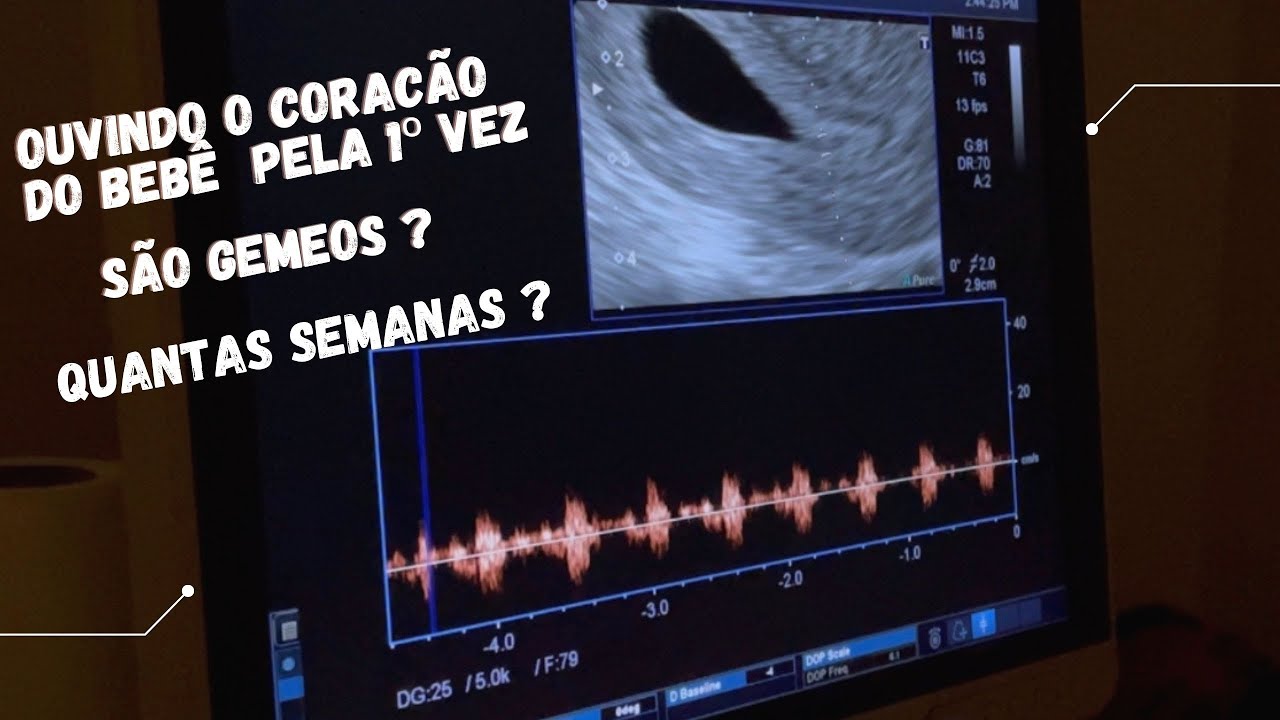 Ouvindo o coração do bebê pela 1º vez - PRIMEIRA ULTRASSOM - YouTube