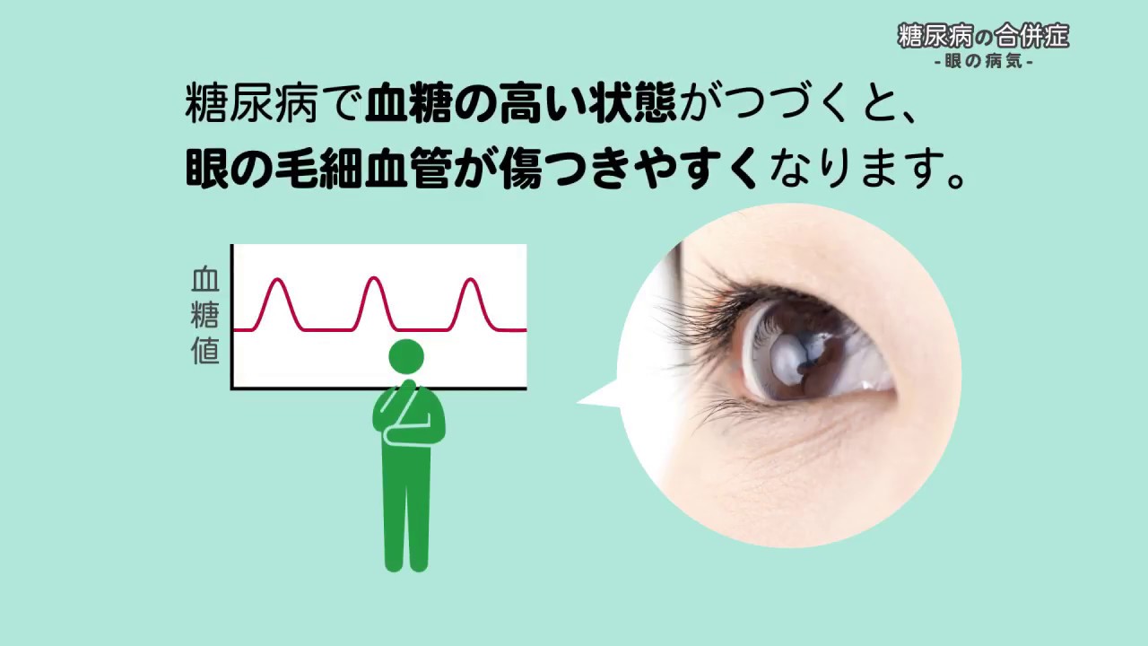 糖尿病網膜症 | 神奈川県川崎市、武蔵新城駅徒歩0分の眼科 | 新城眼科