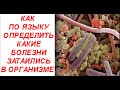 Как по языку можно узнать состояние здоровья человека и внутренних органов организма