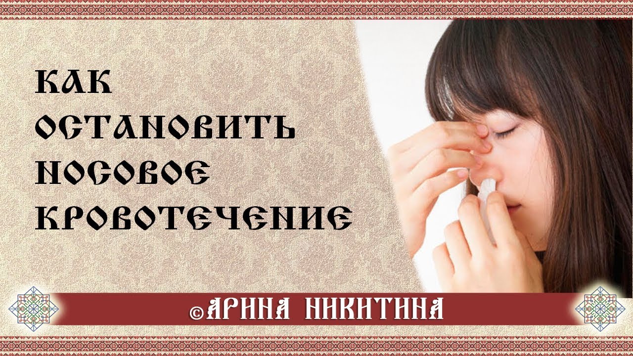 Носовое кровотечение у детей | Кровь из носа у ребенка| Причины носового кровотечения|Арина Никитина