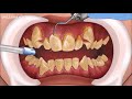 TRANSFORMAÇÃO COM APARELHO DENTAL