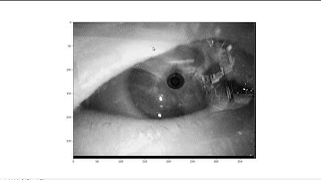 Deep Eye MobileNetV2 Video Demo