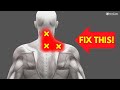 How to fix neck and upper back pain for good