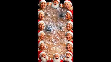 Blackheads Removal | Acne Treatment and Very Satisfying Satisfying Pimple pop #blackheads