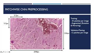 FYP Project using Deep Learning on Breast Histology Images