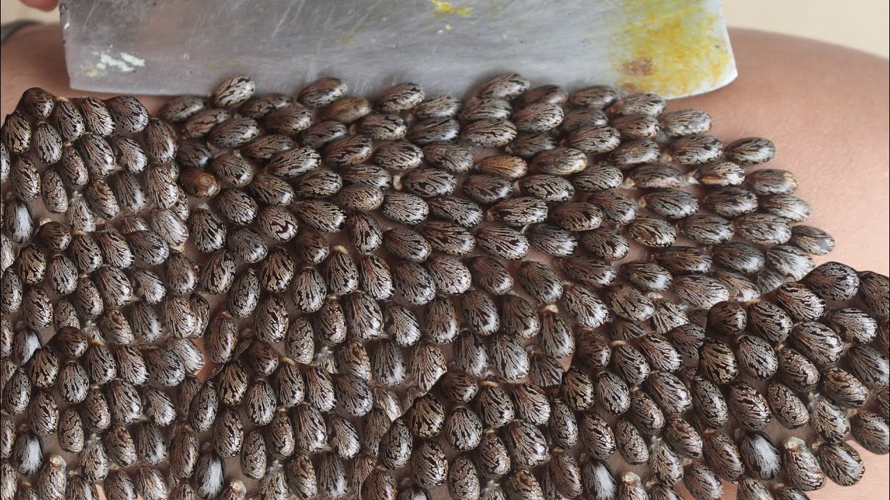 We Help Remove Million Big Ticks on Thigh Humans With Knife Eps44