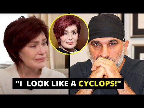 Plastic Surgeon Reacts to Sharon Osbournes 