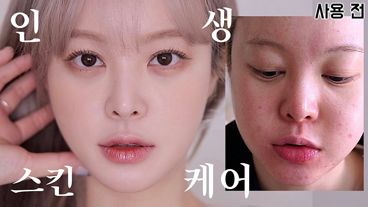 5일만에 피부가 건강해지는데 화장까지 잘먹는 템 리얼 간증 후기💎 | SAEYAN 새얀 - YouTube
