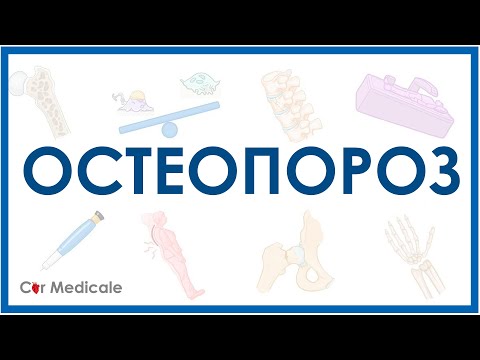 Остеопороз - причины, виды, проявления, диагностика